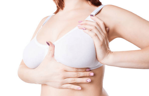 How Long Will My Breast Augmentation Last?