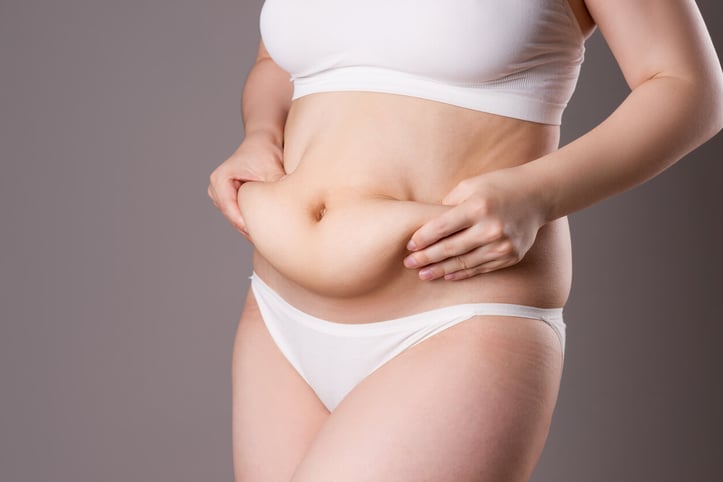 Signs You May Need a Tummy Tuck